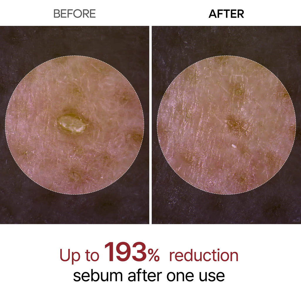 Dr.Melaxin - Peel Shot Exfoliant Rice Ampoule