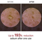 Dr.Melaxin - Peel Shot Exfoliant Rice Ampoule